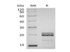 Human MAX Recombinant Protein (RPES1810)