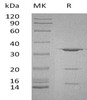 Human PITPNA Recombinant Protein (RPES1823)