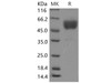 Mouse CD69 Recombinant Protein (Fc tag, ECD) (RPES1825)