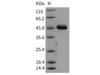 Mouse AKT3 Recombinant Protein (aa 106-479) (Active) (RPES1835)