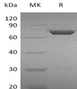 Human PGM2 Recombinant Protein (RPES1861)