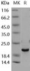 Human DUSP3/VHR Recombinant Protein (Active) (RPES1873)