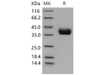 Mouse CADM3 Recombinant Protein (His Tag) (RPES1875)