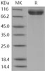 Human NAALADL1 Recombinant Protein (His Tag) (RPES1876)