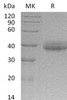 Human CRELD2 Recombinant Protein (RPES1878)