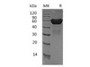 Mouse CXADR/CAR Recombinant Protein (RPES1888)