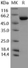 Human TGFBR1/ALK-5 Recombinant Protein (aa 200-503, His & GST Tag) (Active) (RPES1889)