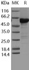 Human MKK6 Recombinant Protein (207 Ser/Asp, 211 Thr/Asp, His & GST Tag) (Active) (RPES1910)