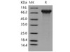 Mouse Kininogen/KNG1 Recombinant Protein (RPES1916)