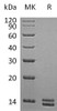 Human S100A8 Recombinant Protein (Baculovirus-Insect Cells, His Tag) (Active) (RPES1917)