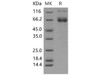 Mouse IFNGR1/CD119 Recombinant Protein (RPES1923)