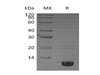 Human Neuritin/NRN1 Recombinant Protein (RPES1928)