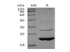 Human Ube2L6 Recombinant Protein (RPES1948)