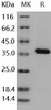 Human PTP1B/PTPN1 Recombinant Protein (His Tag) (Active) (RPES1951)