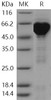 Human HSPD1/HSP60 Recombinant Protein (His & GST Tag) (RPES1972)