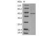 Human TCN2 Recombinant Protein (RPES1993)