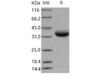 Mouse JAM2/CD322 Recombinant Protein (His Tag) (Active) (RPES1996)