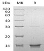 Human DYNLL1 Recombinant Protein (RPES1999)