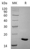 Human Interleukin7A/IL7A Recombinant Protein (Active) (RPES2000)