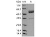 Mouse CD83/HB15 Recombinant Protein (aa 133, Fc Tag) (RPES2003)