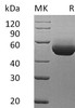 Mouse IL-5RA/IL-5 R Alpha Recombinant Protein  (RPES2004)