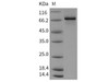 Mouse CHK1/CHEK1 Recombinant Protein (His & GST Tag) (RPES2016)