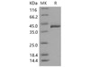 Mouse TCN2 Recombinant Protein (RPES2024)