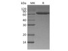 Human ROR1 Recombinant Protein (RPES2070)