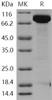Human EED/Embryonic Ectoderm Development Recombinant Protein (His & GST Tag) (RPES2074)