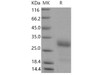 Mouse IGFBP6/IBP-6 Recombinant Protein (RPES2078)