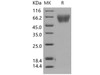 Human TrkA/NTRK1 Recombinant Protein (His Tag) (RPES2079)