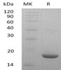 Mouse LIF Recombinant Protein (RPES2086)