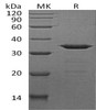 Human NECAP2 Recombinant Protein (RPES2100)