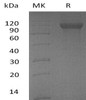 Human DCBLD2/ESDN Recombinant Protein (RPES2101)