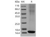 Mouse FABP4/A-FABP Recombinant Protein (HEK293, His Tag) (RPES2105)