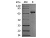 Human IGSF11/BTIGSF Recombinant Protein (RPES2112)