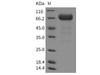 Mouse EphA3 Recombinant Protein (RPES2119)