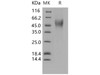 Human CD16b/FCGR3B Recombinant Protein (RPES2121)