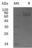 Human IL18BP Recombinant Protein (RPES2124)