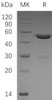 Human UBE2S Recombinant Protein (RPES2126)