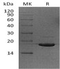 Human UBE2V2/DDVIT1 Recombinant Protein (RPES2169)