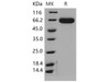 Mouse EphA2 Recombinant Protein (RPES2191)