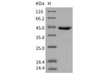 Human RAC1/MIG5 Recombinant Protein (RPES2202)