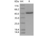 Human CD5 Recombinant Protein (His Tag) (Active) (RPES2206)