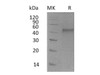 Mouse ST6GALNAC2 Recombinant Protein (RPES2219)