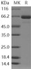 Human SMPD1/ASM Recombinant Protein (His Tag) (RPES2220)
