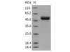 Human MMP1 Recombinant Protein (RPES2223)