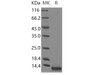 Human CCL8/MCP-2 Recombinant Protein (Yeast, His Tag) (RPES2240)