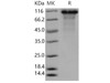 Human Kininogen 1/KNG1 Recombinant Protein (RPES2243)