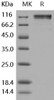 Human CD45/PTPRC Recombinant Protein (Fc Tag) (Active) (RPES2244)